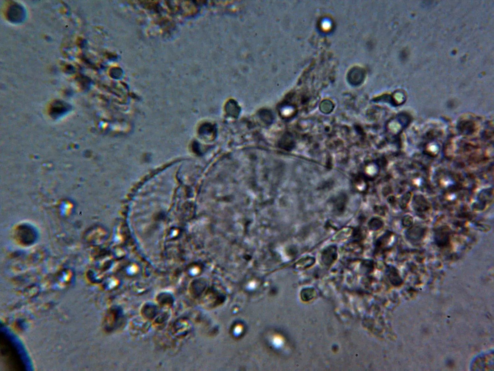 Microscopía de Mycena flavescens - 10 - Queilocistidios 2